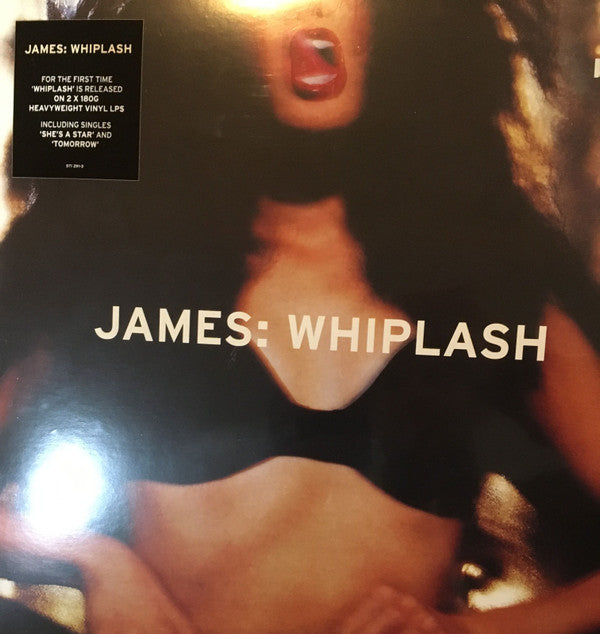 James -  Whiplash